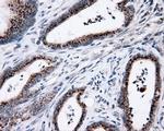 MCL1 Antibody in Immunohistochemistry (Paraffin) (IHC (P))