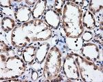 MCL1 Antibody in Immunohistochemistry (Paraffin) (IHC (P))