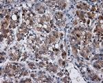 MCL1 Antibody in Immunohistochemistry (Paraffin) (IHC (P))