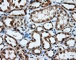 MCL1 Antibody in Immunohistochemistry (Paraffin) (IHC (P))