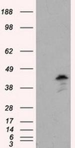 MCL1 Antibody in Western Blot (WB)