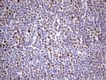 MCM2 Antibody in Immunohistochemistry (Paraffin) (IHC (P))