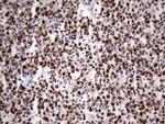 MCM2 Antibody in Immunohistochemistry (Paraffin) (IHC (P))