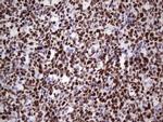 MCM2 Antibody in Immunohistochemistry (Paraffin) (IHC (P))