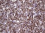MCM2 Antibody in Immunohistochemistry (Paraffin) (IHC (P))