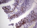 MCM2 Antibody in Immunohistochemistry (Paraffin) (IHC (P))