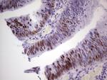 MCM2 Antibody in Immunohistochemistry (Paraffin) (IHC (P))