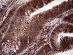 MCM2 Antibody in Immunohistochemistry (Paraffin) (IHC (P))