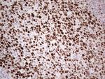 MCM2 Antibody in Immunohistochemistry (Paraffin) (IHC (P))