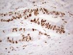 MCM2 Antibody in Immunohistochemistry (Paraffin) (IHC (P))