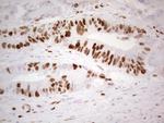 MCM2 Antibody in Immunohistochemistry (Paraffin) (IHC (P))