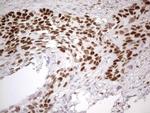 MCM2 Antibody in Immunohistochemistry (Paraffin) (IHC (P))