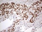 MCM2 Antibody in Immunohistochemistry (Paraffin) (IHC (P))