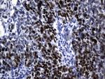 MCM2 Antibody in Immunohistochemistry (Paraffin) (IHC (P))