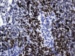 MCM2 Antibody in Immunohistochemistry (Paraffin) (IHC (P))