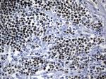 MCM2 Antibody in Immunohistochemistry (Paraffin) (IHC (P))