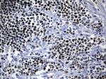 MCM2 Antibody in Immunohistochemistry (Paraffin) (IHC (P))