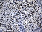 MCM2 Antibody in Immunohistochemistry (Paraffin) (IHC (P))