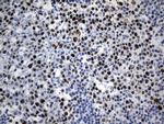 MCM2 Antibody in Immunohistochemistry (Paraffin) (IHC (P))