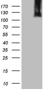 MCM2 Antibody in Western Blot (WB)