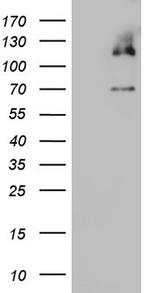 MCM2 Antibody in Western Blot (WB)