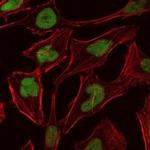 MCM2 Monoclonal Antibody (1E7)