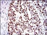 MCM2 Antibody in Immunohistochemistry (Paraffin) (IHC (P))