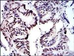 MCM2 Antibody in Immunohistochemistry (Paraffin) (IHC (P))