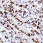 MCM2 Monoclonal Antibody (SP85)