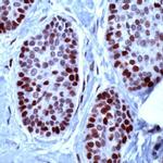 MCM2 Antibody in Immunohistochemistry (IHC)
