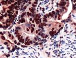 MCM2 Antibody in Immunohistochemistry (IHC)