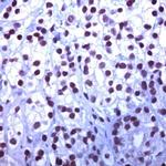 MCM5 Antibody in Immunohistochemistry (IHC)