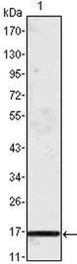 MCP-1 Monoclonal Antibody (1A7B8)