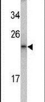 MCTS1 Antibody in Western Blot (WB)