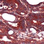 FABP3 Antibody in Immunohistochemistry (IHC)