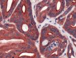 FABP3 Antibody in Immunohistochemistry (IHC)
