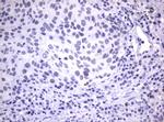 MDM2 Antibody in Immunohistochemistry (Paraffin) (IHC (P))