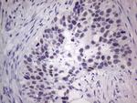 MDM2 Antibody in Immunohistochemistry (Paraffin) (IHC (P))