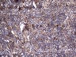 MDM2 Antibody in Immunohistochemistry (Paraffin) (IHC (P))