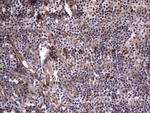 MDM2 Antibody in Immunohistochemistry (Paraffin) (IHC (P))