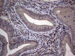 MDM2 Antibody in Immunohistochemistry (Paraffin) (IHC (P))