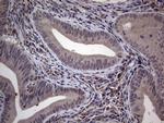 MDM2 Antibody in Immunohistochemistry (Paraffin) (IHC (P))