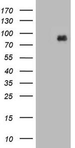MDM2 Antibody in Western Blot (WB)