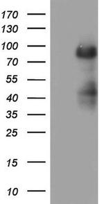 MDM2 Antibody in Western Blot (WB)