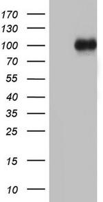 MDM2 Antibody in Western Blot (WB)
