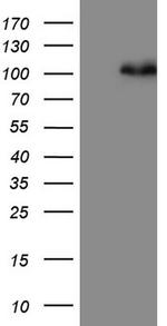 MDM2 Antibody in Western Blot (WB)
