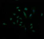 MDM4 Antibody in Immunocytochemistry (ICC/IF)