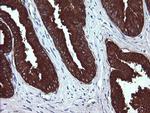 MDM4 Antibody in Immunohistochemistry (Paraffin) (IHC (P))
