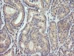 MDM4 Antibody in Immunohistochemistry (Paraffin) (IHC (P))