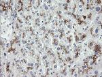 MDM4 Antibody in Immunohistochemistry (Paraffin) (IHC (P))